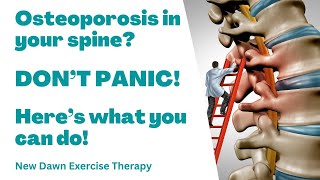 Osteoporosis in Your Spine DONT PANIC [upl. by Eisak409]