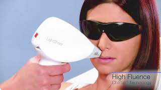 Lumenis LightSheer Desire Laser Hair Removal [upl. by Zetrauq234]