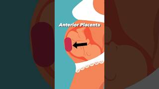 Anterior Placenta and Baby Kicks pregnancy [upl. by Secunda]