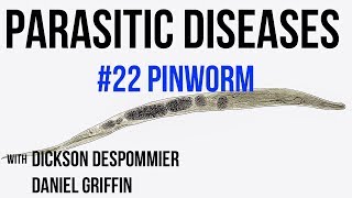 Parasitic Diseases Lectures 22 Pinworm [upl. by Fleeta]