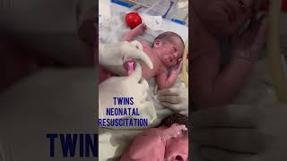 👩‍⚕️🤱How to do Twin’s neonatal resuscitationumbilical cord clamping and cuttingbaby resuscitation [upl. by Oab]