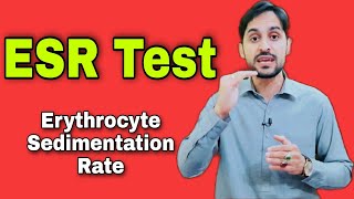 ESR Test  Erythrocyte Sedimentation Rate  High ESR Causes [upl. by Roche]