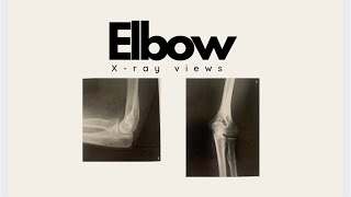 Elbow xray positioning comedy project [upl. by Eelydnarb]