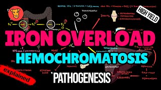 HEMOCHROMATOSIS Pathogenesis Mechanism of clinical symptoms Diagnostic criteria Treatment [upl. by Aneloj]