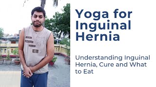 Yoga for Inguinal Hernia  Causes Symptoms and Yogic Treatment [upl. by Arikehs945]