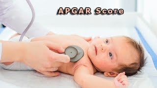 Apgar score  with easy steps [upl. by Selry]