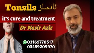 Tonsillitis and its treatment Homeopathic DrNasir Aziz Consult us before operation [upl. by Aglo]