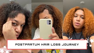 Postpartum Hair Loss Journey How I grew back my hair  the products I used  styling my hair [upl. by Ahsiener]