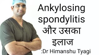 Ankylosing spondylitis और उसका इलाजTreatment [upl. by Castillo]