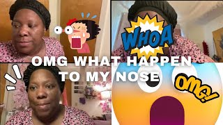 What Happened on Day 2 PostNose Piercing healing nosepiercing [upl. by Seow]