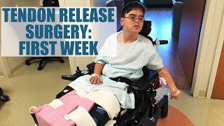 Vlog Tendon Release Week One [upl. by Marylou]