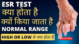 ESR test kya hota hai  esr badhne se kya hota hai  esr test hindi [upl. by Gilberta]