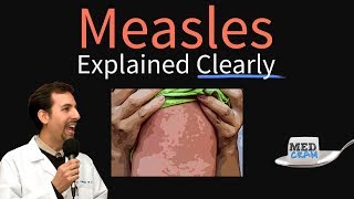 Measles rubeola Explained Clearly by MedCramcom [upl. by Chellman]