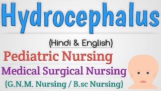 Hydrocephalus In Hindi  Hydrocephalus In Pediatric Nursing [upl. by Nolitta]