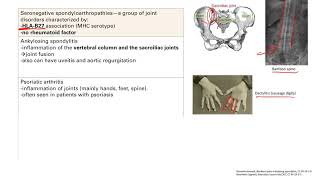 Seronegative Spondyloarthropathies  MSK  Step 1 Simplified [upl. by Broderick]