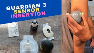 Medtronic Diabetes Guardian 3 Sensor insertion  How to insert the Guardian 3 Sensor [upl. by Schonfield456]