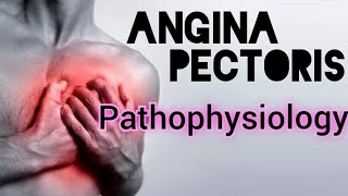 PATHOPHYSIOLOGY OF ANGINA PECTORIS [upl. by Lehcor]