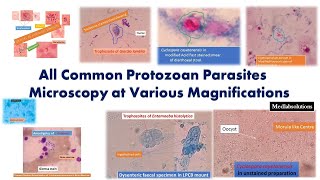 All Common Protozoal Parasites Microscopy [upl. by Ekaj]