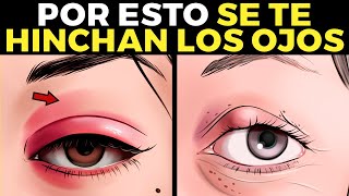 11 razones por las que se te hincha el ojo [upl. by Reiser]