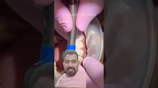 ASMR🔊 Doctor at work veneers compositebonding dentist asmrasmrsounds [upl. by Ayikahs]