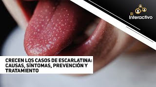 Crecen los casos de escarlatina causas síntomas prevención y tratamiento [upl. by Rebak203]