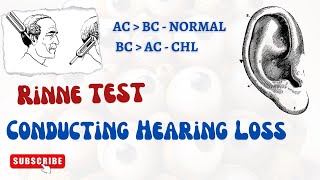 What is Rinne test  Conducting hearing loss  ENT By AWG  Ear Examination [upl. by Anilosi120]