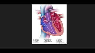 A case of Cyanotic heart disease  100 casebook [upl. by Hezekiah]