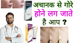 Glyco 6 Glyco 12 क्रीमको गोरा होने के लिए कैसे लगाया जाता है [upl. by Edrick]