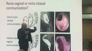 Radiological interpretation of cloacal MRI images by professor Alberto penia [upl. by Anaitit]