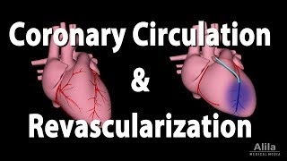 Coronary Circulation and Revascularization Animation [upl. by Ecille99]