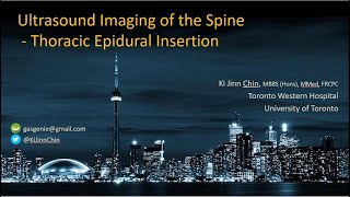 Ultrasound Imaging for Thoracic Epidural extended [upl. by Syst315]