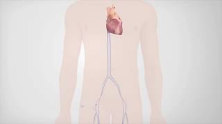 Radiofrequency Catheter Ablation [upl. by Jallier739]