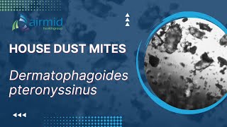 House Dust Mites  under the microscope at airmid healthgroup [upl. by Ynnor]