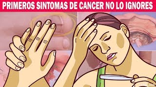 Primeros Síntomas y Signos de Cáncer que no debemos ignorar ¡Mucho Cuidado [upl. by Endys609]