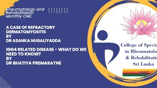 Refractory Dermatomyositis by Dr Asanka Nugaliyadda  IgG4 Related Disease by Dr Bhatiya Premaratne [upl. by Ronen]