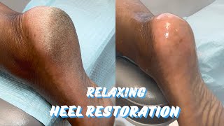 RELAXING DEAD SKIN REMOVAL HEEL RESTORATION [upl. by Henden]