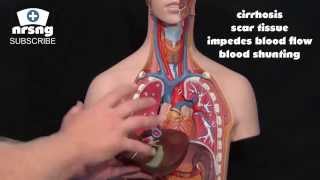 Esophageal Varices Animation Nursing Overview [upl. by Enelia]