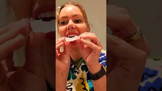 opalescence 16 carbamide peroxide professional home teeth whitening how to use guide by a dentist [upl. by Lowenstern]