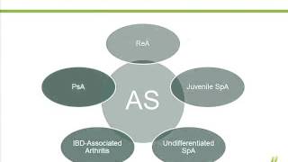 Identification and Classification of Spondyloarthropathies [upl. by Sheffie968]