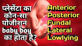 प्लेसेंटा का कौनसा पोजीशन baby boy का होता है AnteriorPosteriorFundalLateral Lowlying plecenta [upl. by Jonna]