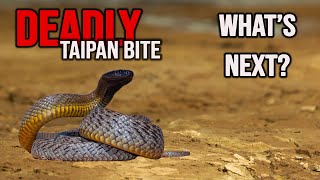 Nearly Fatal Taipan Bite Draws Unwanted Attention to Responsible Snake Keepers [upl. by Ynotna]