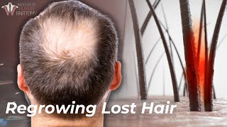 The Science of Hair Loss How to Prevent amp Regrow Lost Hair [upl. by Hanleigh370]