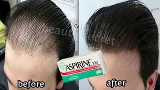 Put this ingredient in your shampoo👌it accelerates hair growth and treats baldness [upl. by Issim]