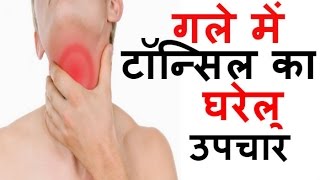 गले में टॉन्सिल का सरल उपचार  Natural Home Remedies For Tonsillitis Treatment [upl. by Dare]