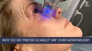 Powerful Skin Tightening with Radio Frequency Microneedling [upl. by Aneleasor]