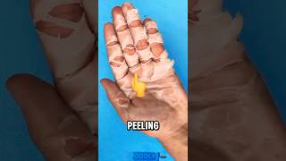 Why Your Skin Peels Like This trending feedshorts education [upl. by Greg996]