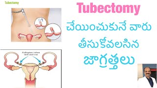 Tubectomy చేయించుకునే ముందు జాగ్రత్తలు precautions for Tubectomy operation anemiahigh bp [upl. by Cordelia]