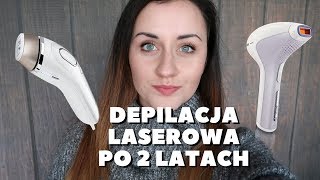 Depilacja laserowa IPL po 2 latach Czy się OPŁACA [upl. by Edrei]