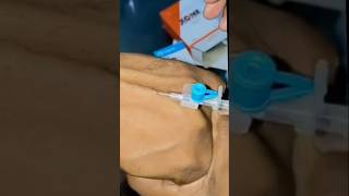 Cannula insertion 💉🩹  ivcannulation medical hospital medicine satyujribadiya doctor [upl. by Sancho]