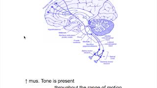 Extrapyramidal neuron lesionRigiditySpasticity VS Rigidity [upl. by Elleinnod]